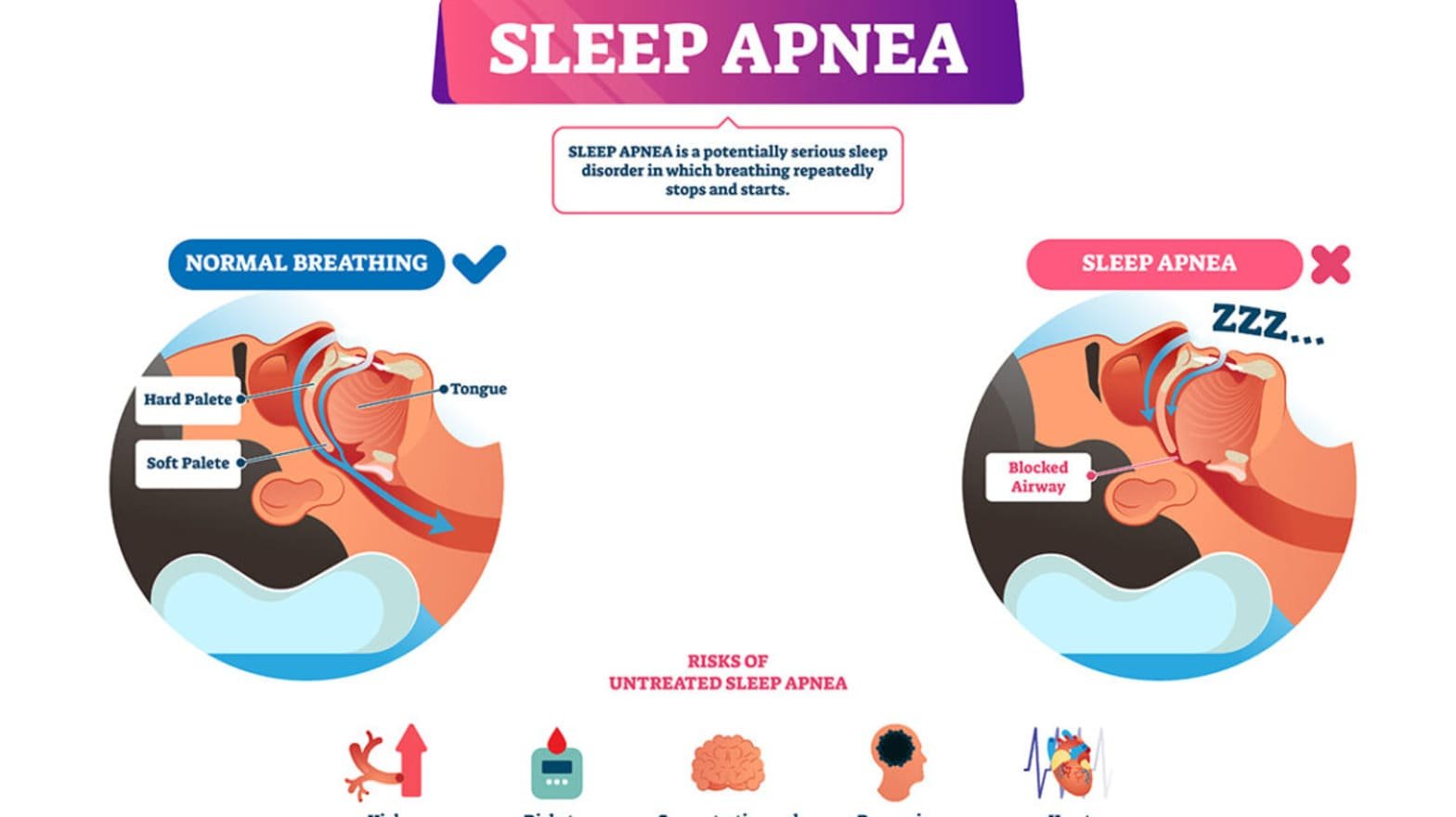 Sleep Apnea and Sleep Disorder Treatment